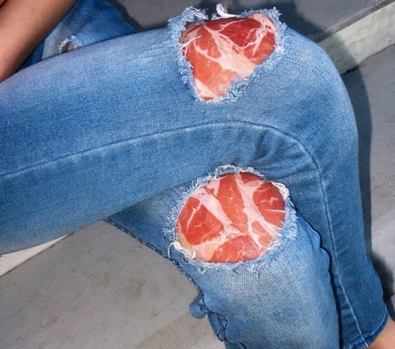 The Meat Knee Patches | Imgur.com/fWn7aw7