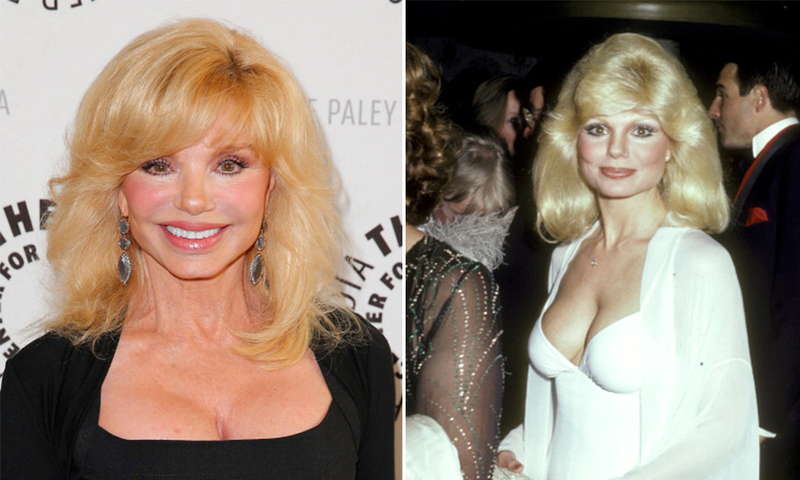 Loni Anderson (born 1945) | Getty Images Photo by Joe Scarnici/WireImage & Ron Galella Collection