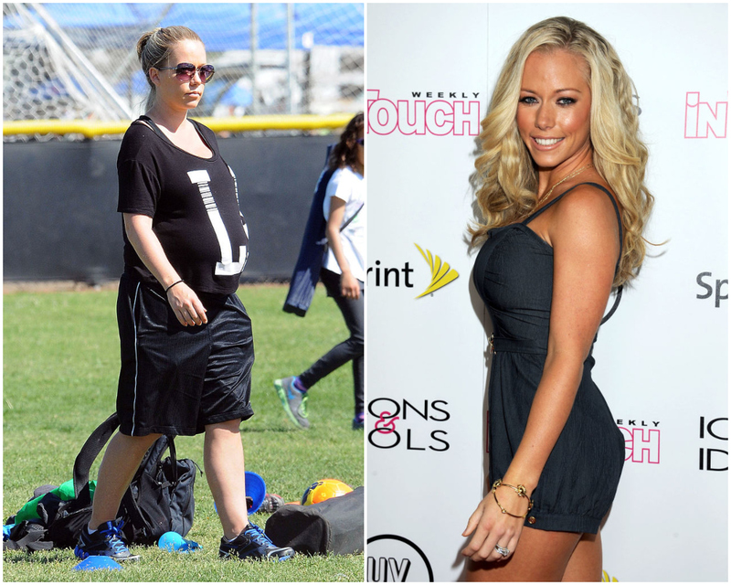 Kendra Wilkinson – 55 Pounds | Getty Images Photo by Chinchilla/Bauer-Griffin/GC Images & Valerie Macon