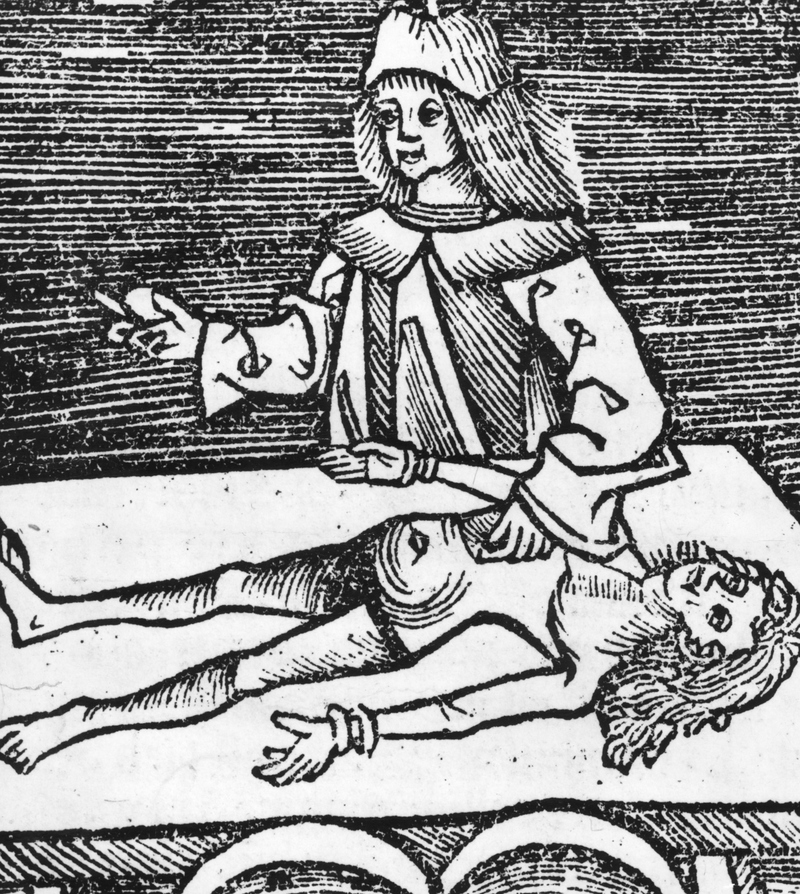 Medieval Surgery Was Often Fatal | Getty Images Photo by Hulton Archive