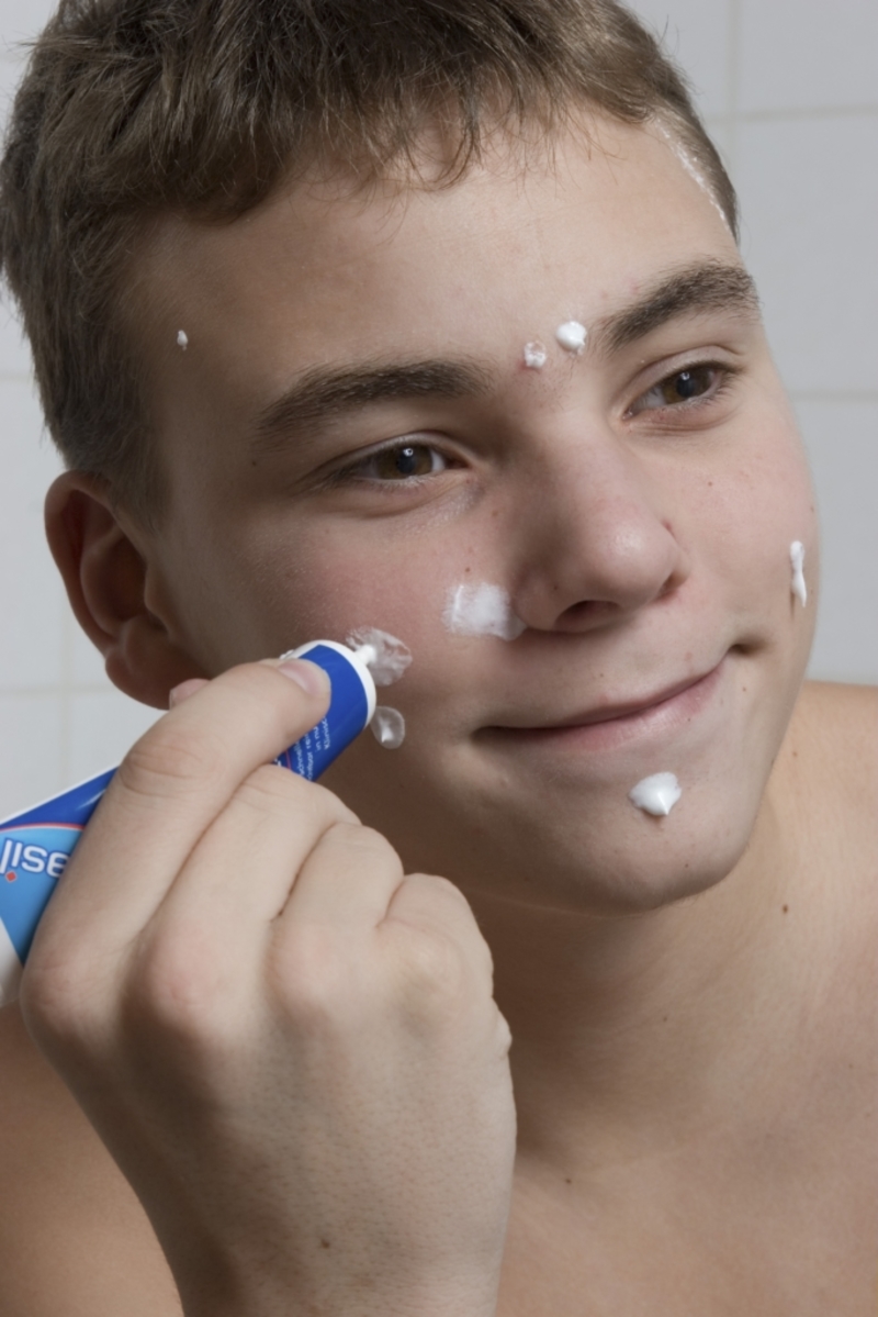 Acne Medications | Getty Images Photo by Stefan Klein/ullstein bild via Getty Images