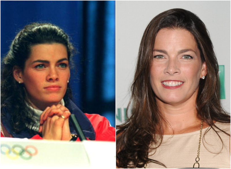 Nancy Kerrigan | Getty Images Photo by Phil Cole 