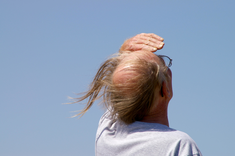 Long Hair on a Bald Head | Alamy Stock Photo by Avpics 