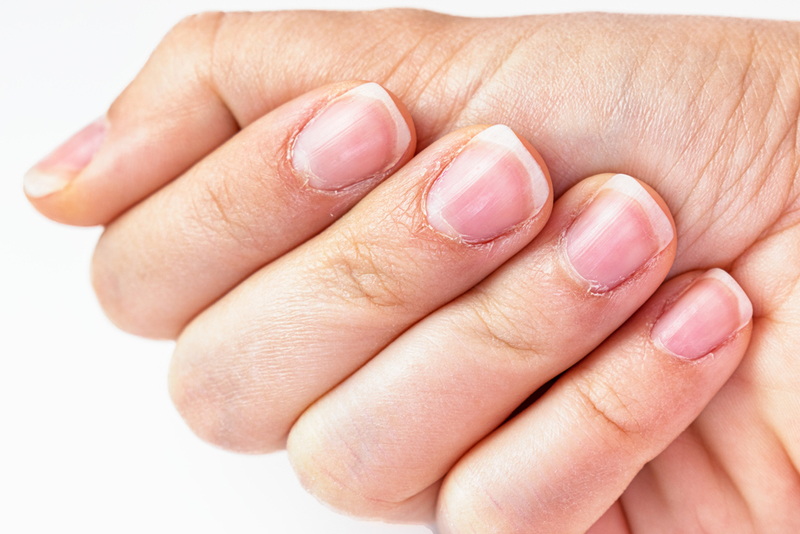 Clean Up Around Your Cuticles | Shutterstock