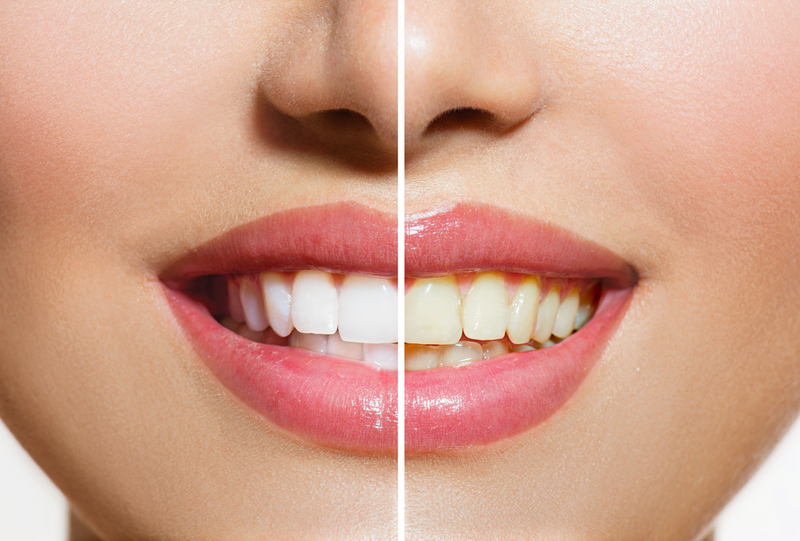 Healthy Teeth Are Supposed to Be White | Shutterstock