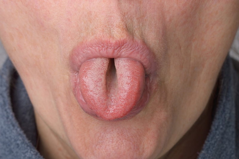 Rolling Your Tongue Is a Genetic Trait | Shutterstock