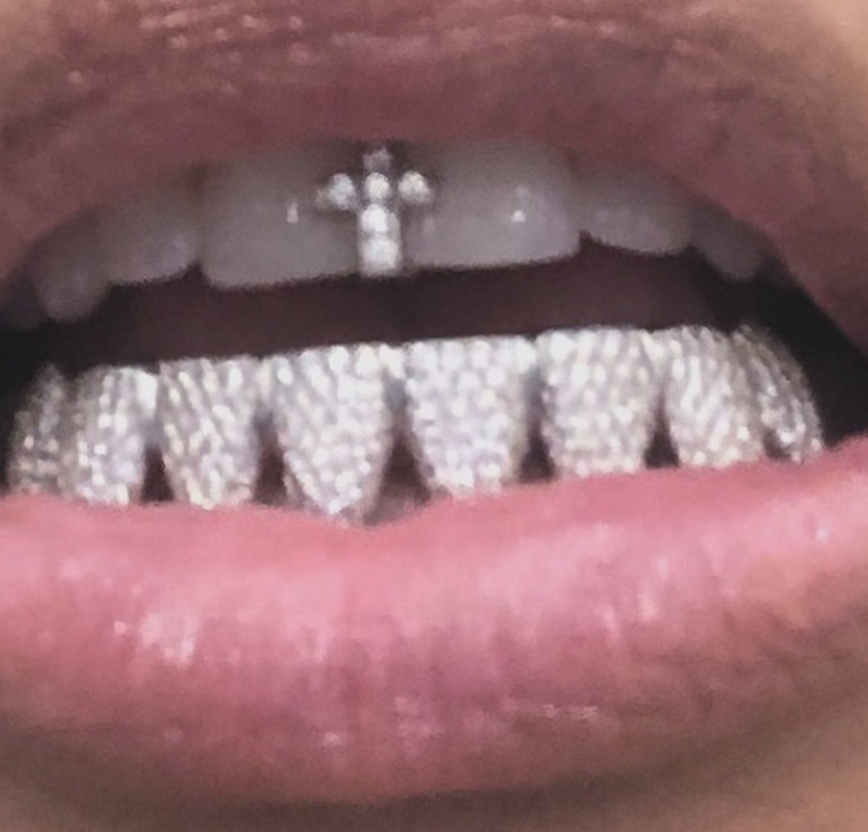 Teeth Grills | Instagram/@kimkardashian