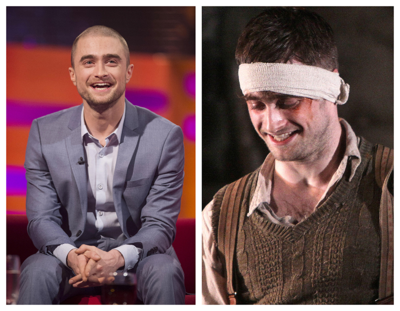Daniel Radcliffe Turned Into a Cripple in ‘The Cripple of Inishmaan’ | Alamy Stock Photo by Matt Crossick/PA Images & WENN Rights Ltd