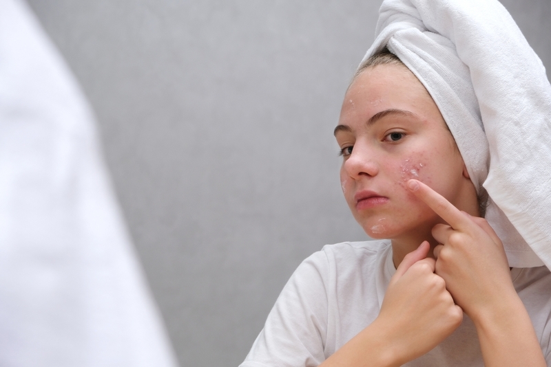 Ayuda contra el acné | Shutterstock Photo by YULIYA Shustik