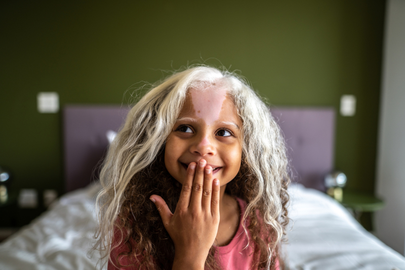 Ein Schock an weißen Haaren | Getty Images Photo by FG Trade