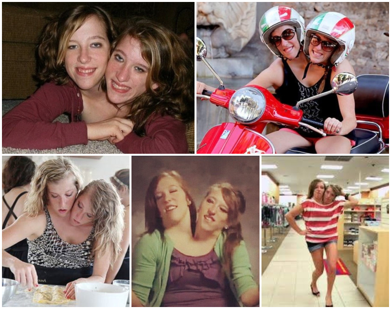 Zusammen fürs Leben; Die Geschichte der zusammengewachsenen Zwillinge | Instagram/@abbyandbrittany & Facebook/@Abby-and-Brittany