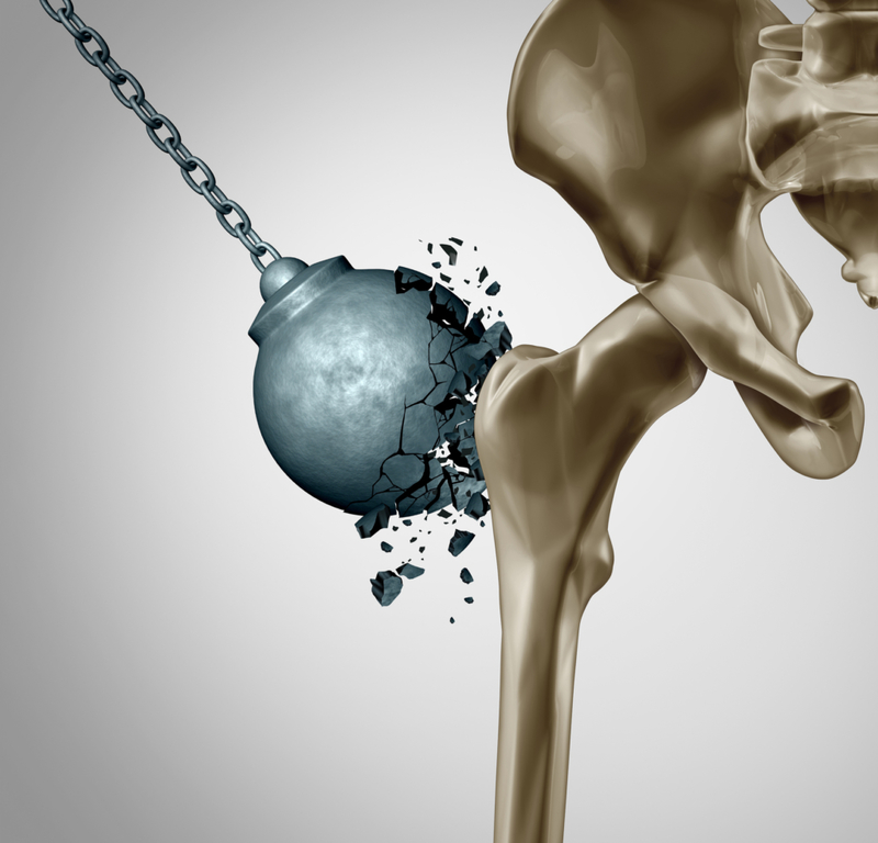Das Gen, dass dir unzerbrechliche Knochen gibt | Getty Images Photo by wildpixel