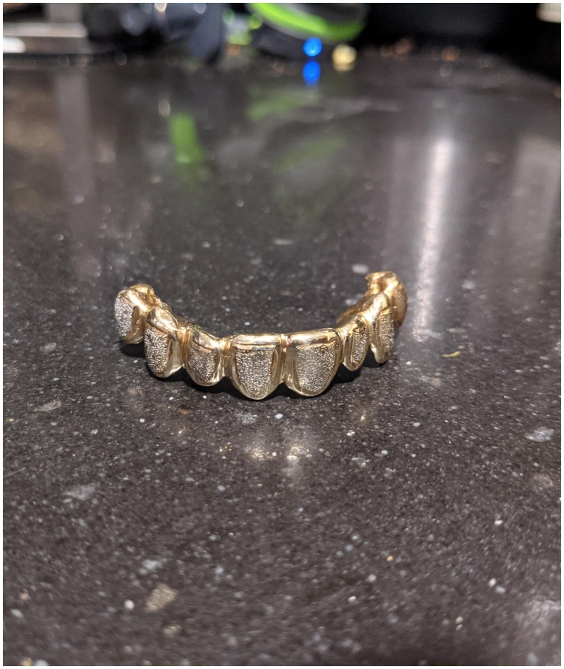 A Golden Diamond Teeth Grill | Reddit.com/808snorkeler