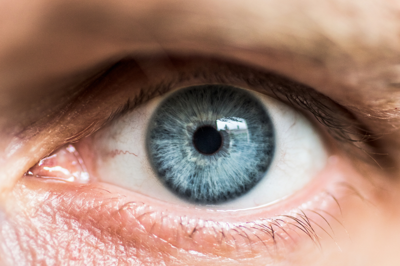 That Little Bump in Your Eye | Shutterstock