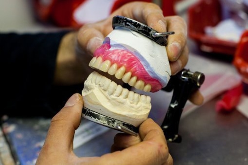 Dentures Used to Be Made of Real Teeth | Getty Images Photo by Bettmann